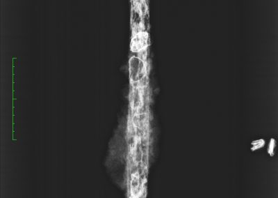 radiographie d'un glaive gaulois
